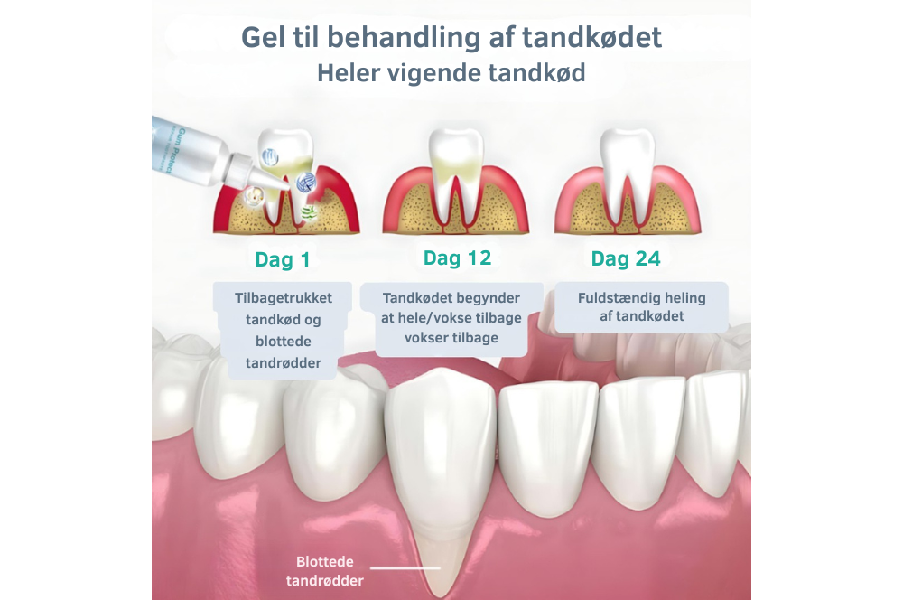 GumShield+™ - Den Naturlige Løsning til Sundt Tandkød
