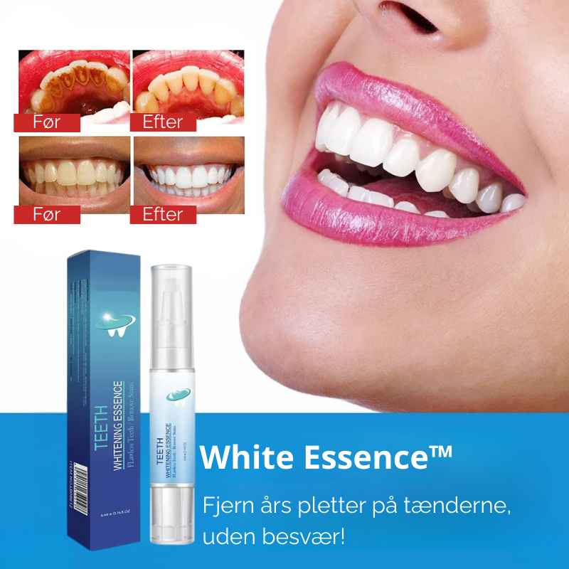 White Essence™ | Fjern års pletter på tænderne, uden besvær!
